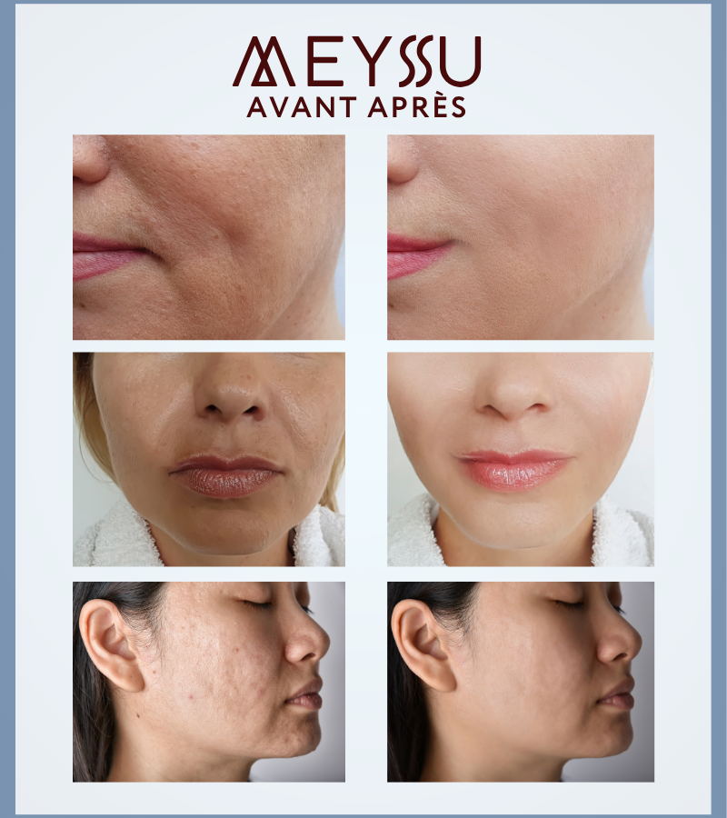 Pack Jeunesse – Beauté Professionnelle